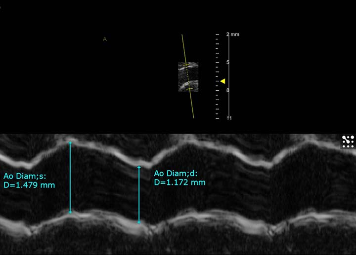 Anatomical MMode FUJIFILM VisualSonics